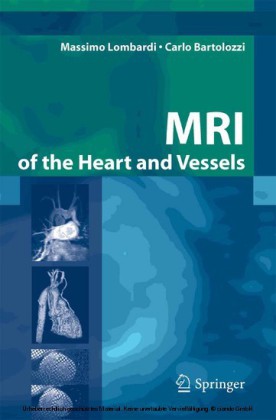 MRI of the Heart and Vessels