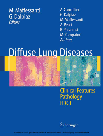 Diffuse Lung Diseases main product photo