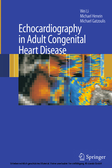 Echocardiography in Adult Congenital Heart Disease main product photo