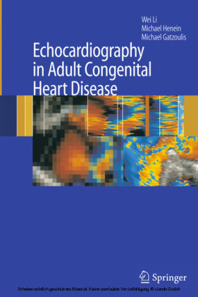 Echocardiography in Adult Congenital Heart Disease