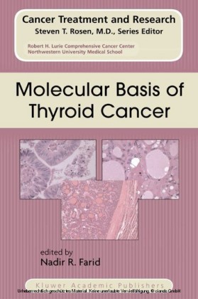 Molecular Basis of Thyroid Cancer