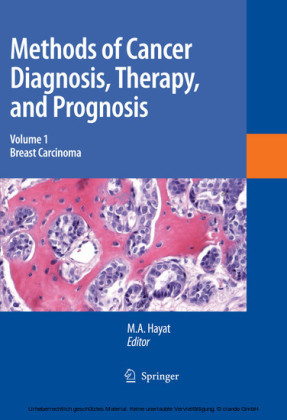 Methods of Cancer Diagnosis, Therapy and Prognosis