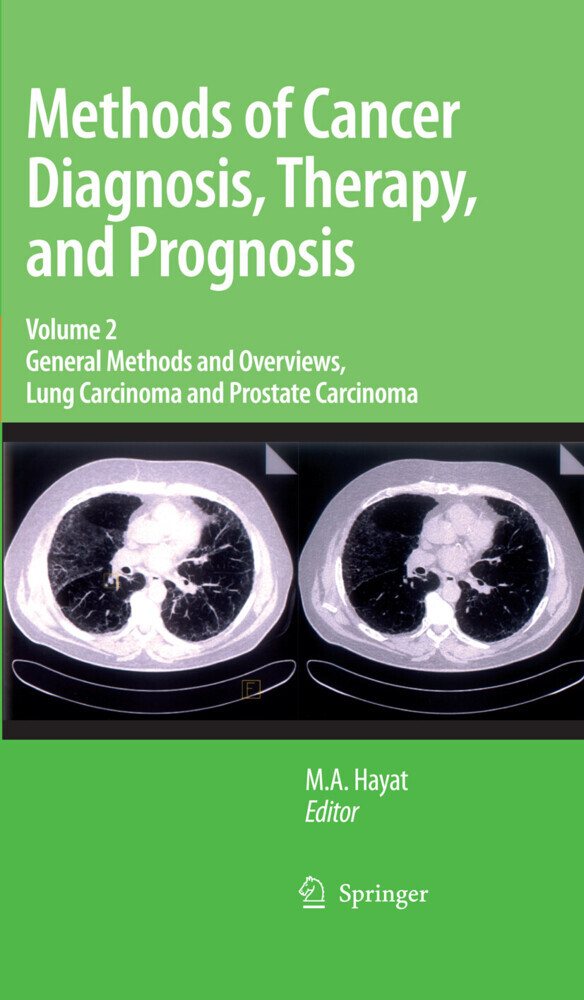 Methods of Cancer Diagnosis, Therapy and Prognosis main product photo