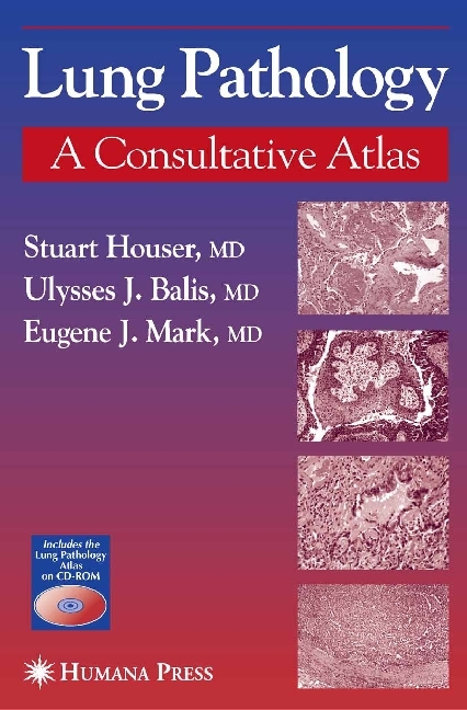 Lung Pathology main product photo