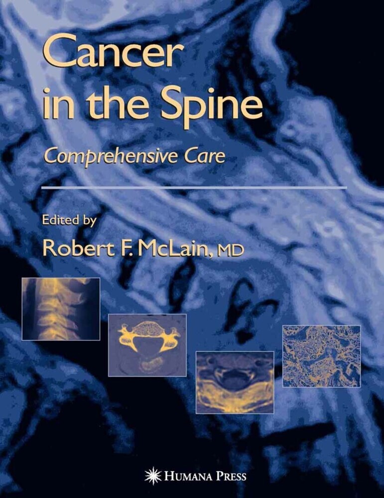 Cancer in the Spine main product photo