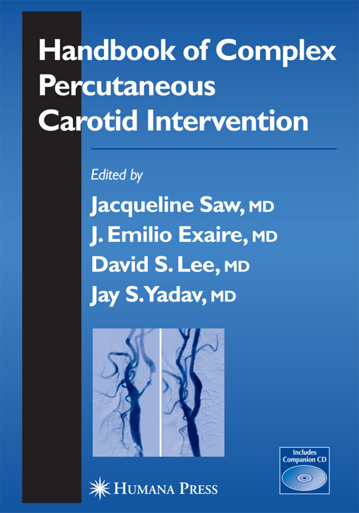 Handbook of Complex Percutaneous Carotid Intervention main product photo