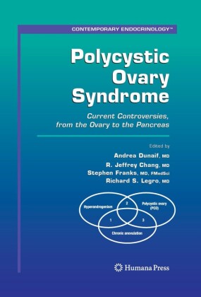 Polycystic Ovary Syndrome