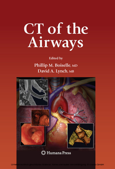 CT of the Airways main product photo