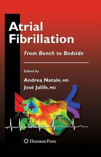 Atrial Fibrillation main product photo