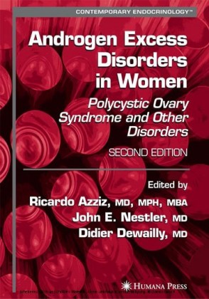 Androgen Excess Disorders in Women
