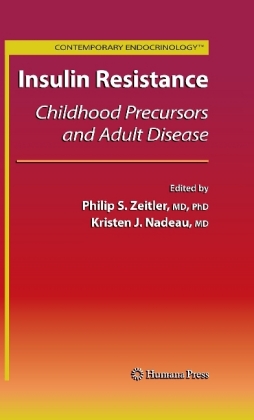 Insulin Resistance
