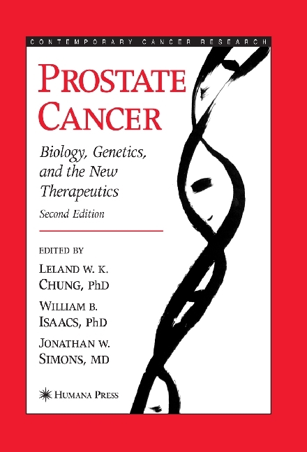 Prostate Cancer main product photo