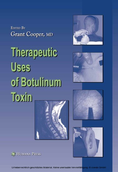 Therapeutic Uses of Botulinum Toxin main product photo