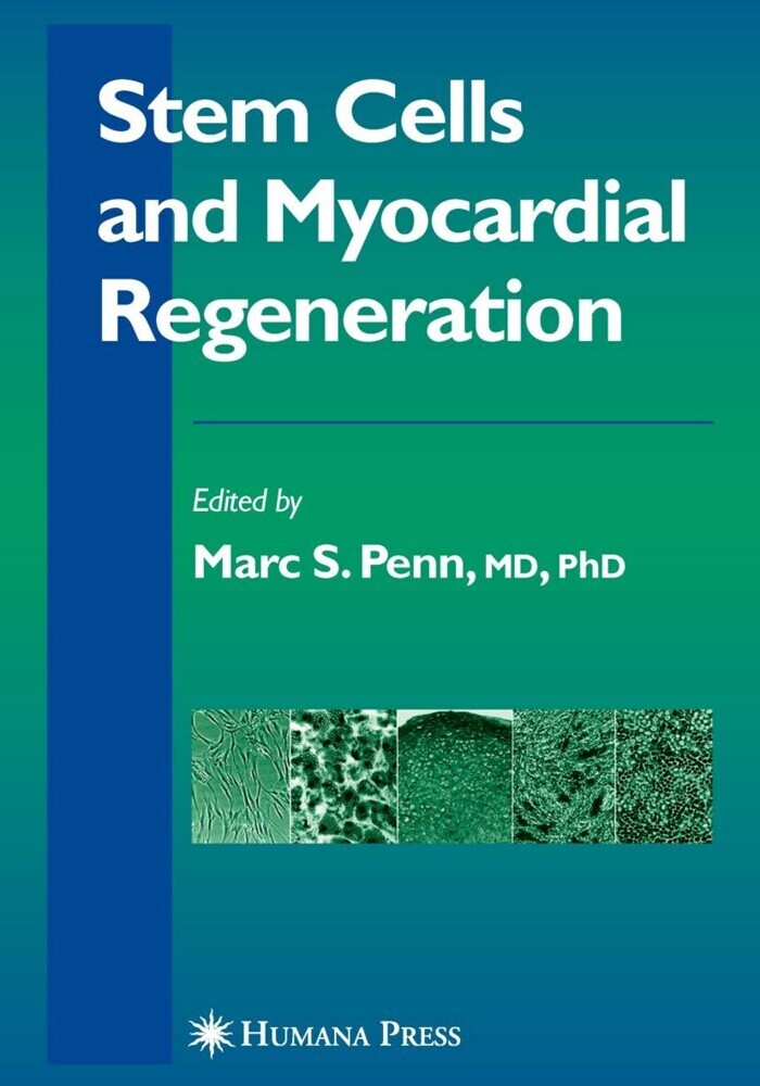 Stem Cells and Myocardial Regeneration main product photo