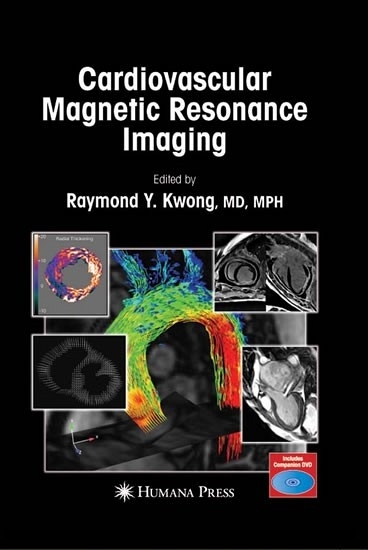 Cardiovascular Magnetic Resonance Imaging main product photo