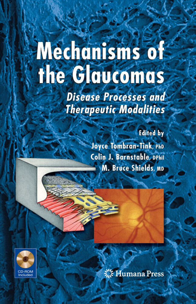 Mechanisms of the Glaucomas main product photo