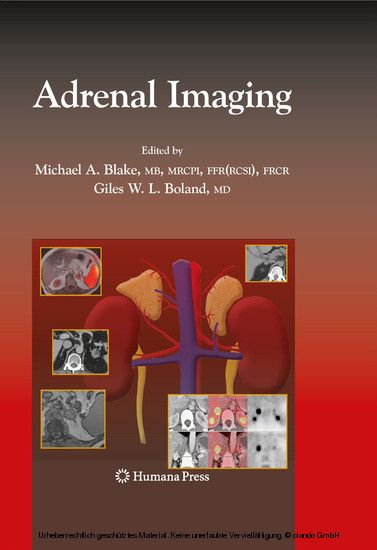Adrenal Imaging main product photo