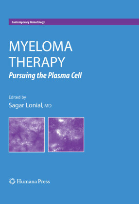 Myeloma Therapy
