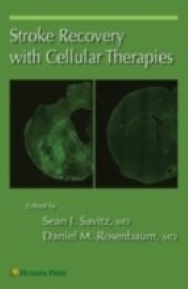 Stroke Recovery with Cellular Therapies