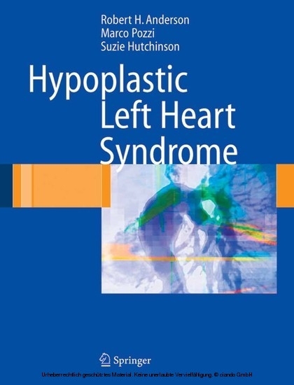 Hypoplastic Left Heart Syndrome main product photo