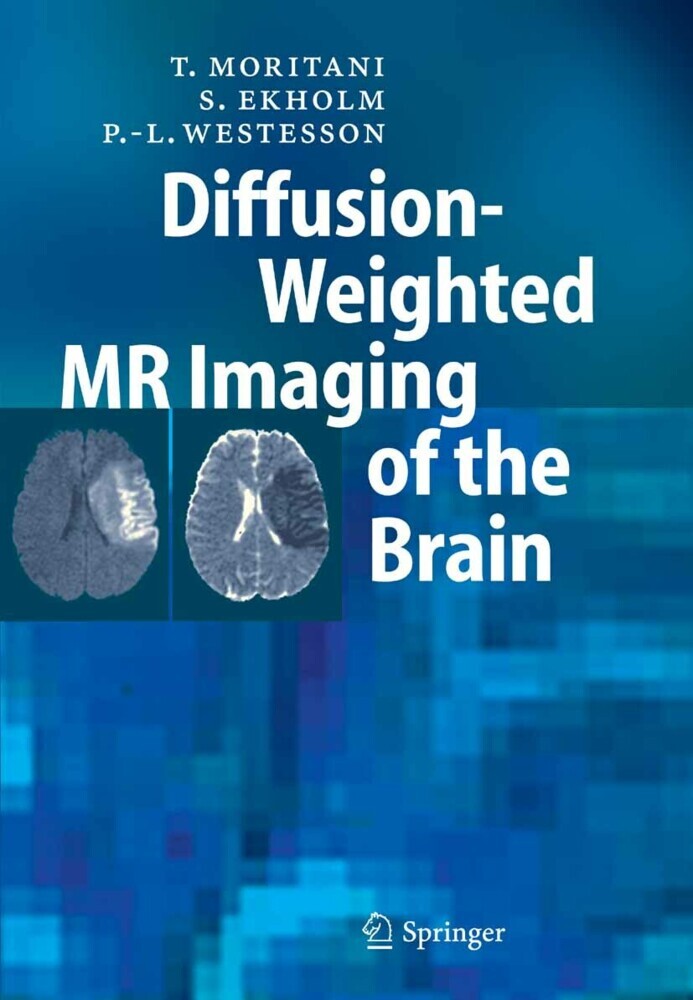 Diffusion-Weighted MR Imaging of the Brain main product photo