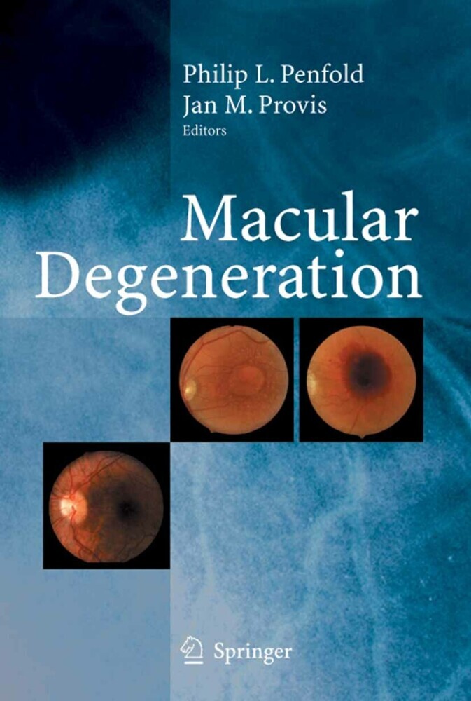 Macular Degeneration main product photo