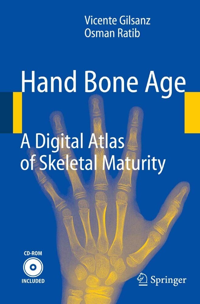 Hand Bone Age main product photo