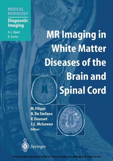 MR Imaging in White Matter Diseases of the Brain and Spinal Cord main product photo