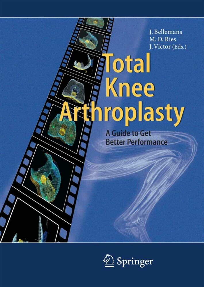 Total Knee Arthroplasty main product photo