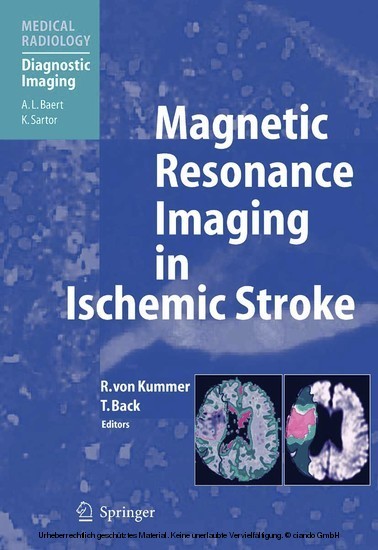 Magnetic Resonance Imaging in Ischemic Stroke main product photo