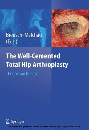 The Well-Cemented Total Hip Arthroplasty