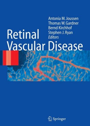 Retinal Vascular Disease