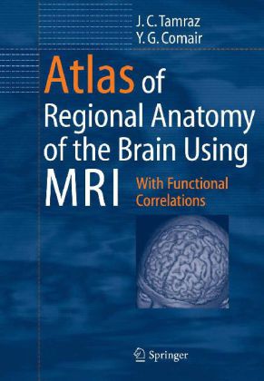 Atlas of Regional Anatomy of the Brain Using MRI - With Functional Correlations. Foreword by Hans O. Lüders