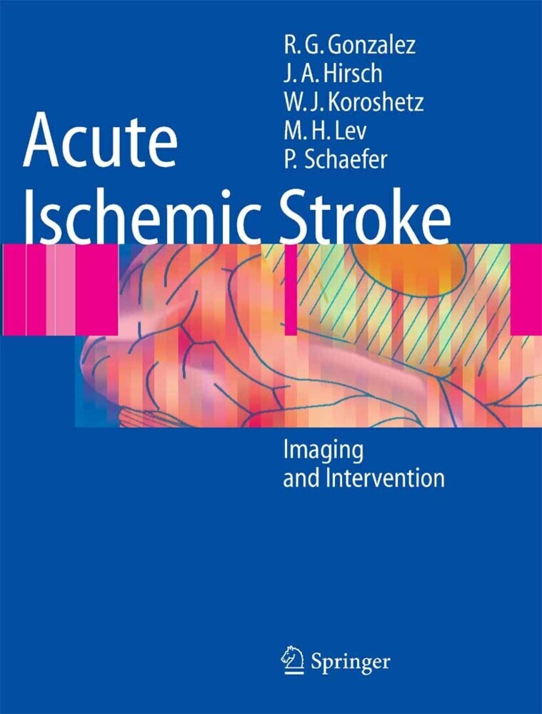 Acute Ischemic Stroke main product photo