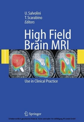 High Field Brain MRI