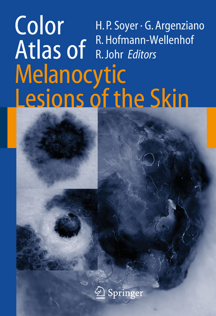 Color Atlas of Melanocytic Lesions of the Skin main product photo