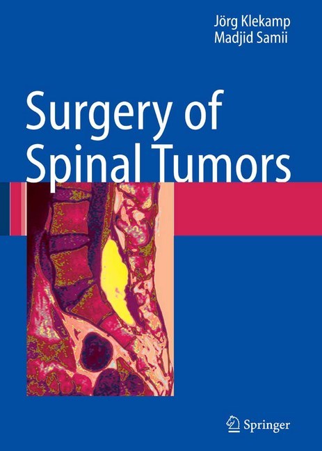 Surgery of Spinal Tumors main product photo