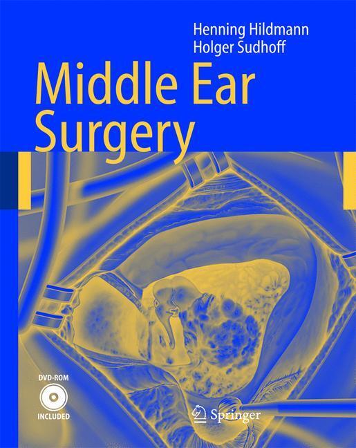 Middle Ear Surgery main product photo