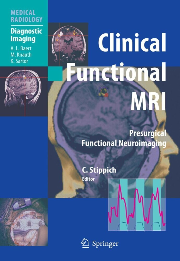 Clinical Functional MRI main product photo