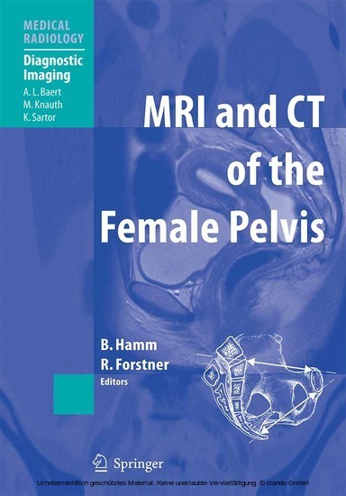 MRI and CT of the Female Pelvis main product photo