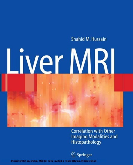 Liver MRI main product photo