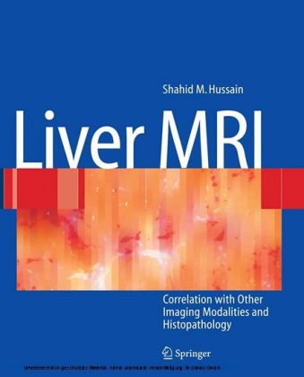 Liver MRI