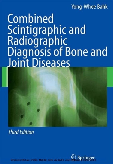 Combined Scintigraphic and Radiographic Diagnosis of Bone and Joint Diseases main product photo