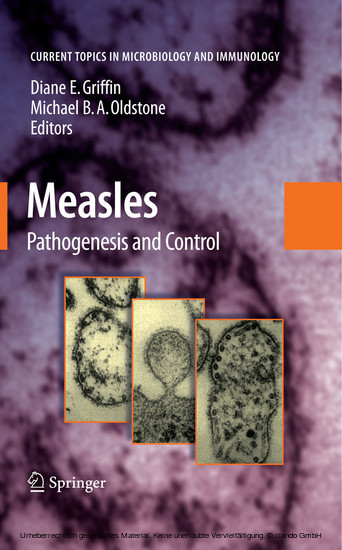 Measles main product photo