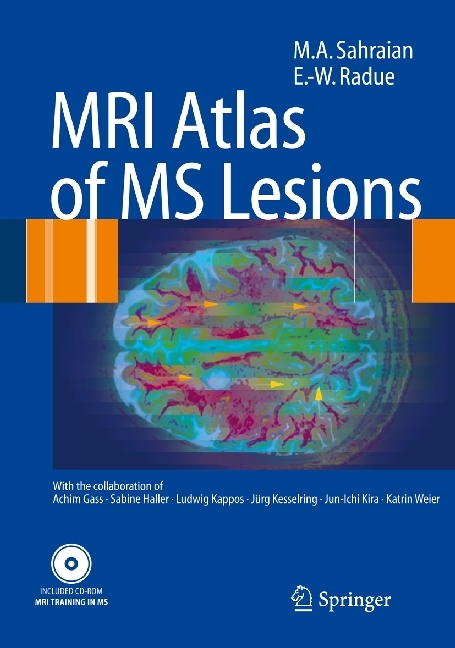 MRI Atlas of MS Lesions main product photo