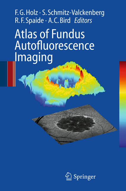 Atlas of Fundus Autofluorescence Imaging main product photo