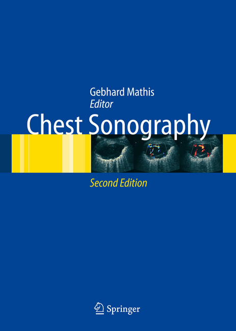 Chest Sonography main product photo