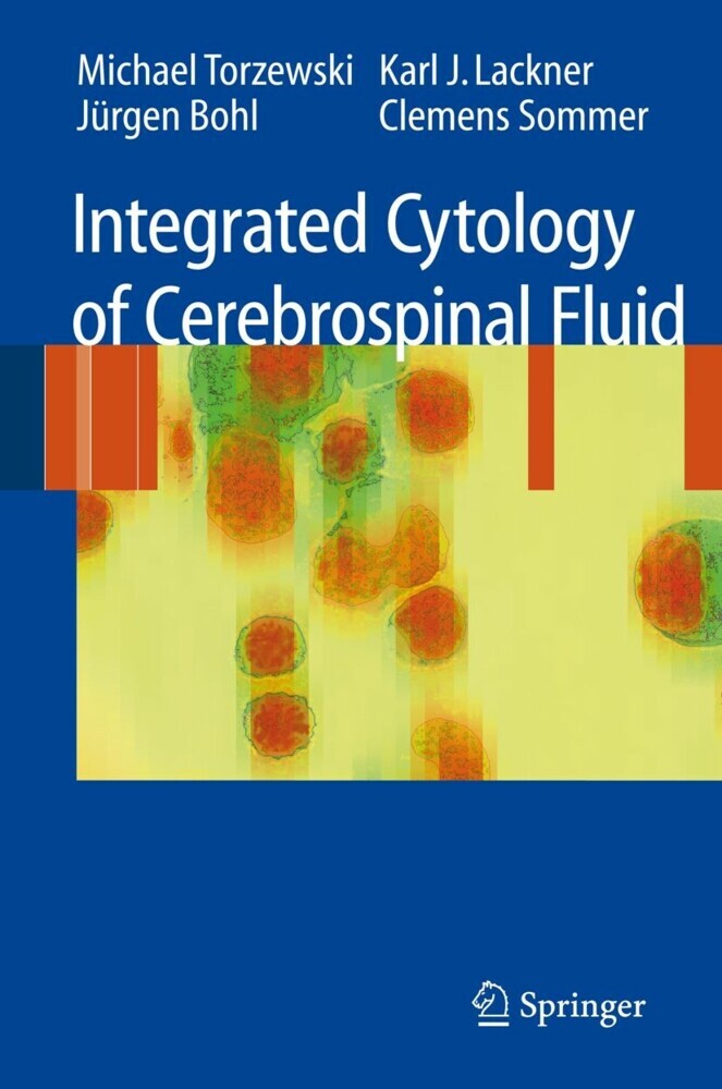 Integrated Cytology of Cerebrospinal Fluid main product photo