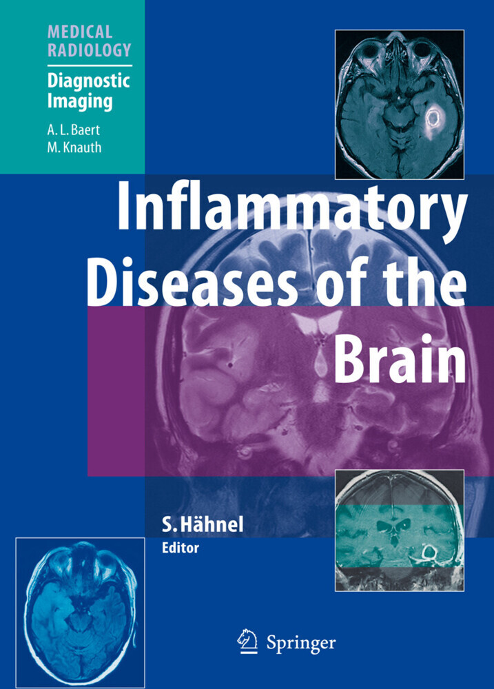 Inflammatory Diseases of the Brain main product photo