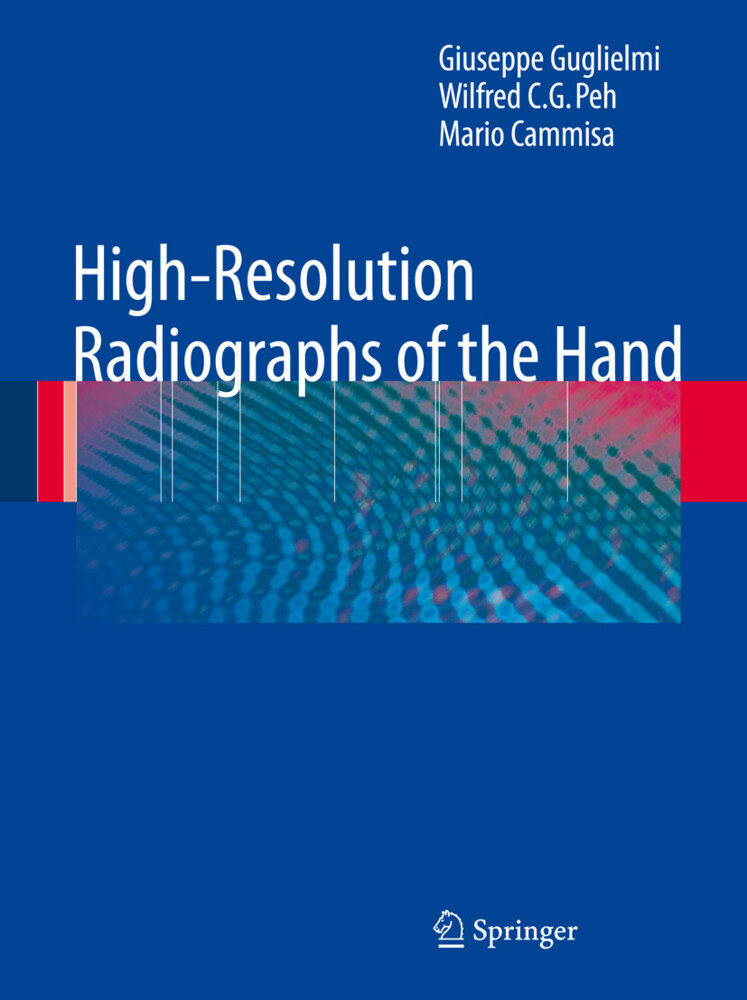 High-Resolution Radiographs of the Hand main product photo
